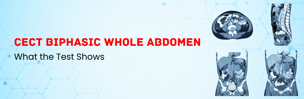  CECT Biphasic Whole Abdomen: What the Test Shows